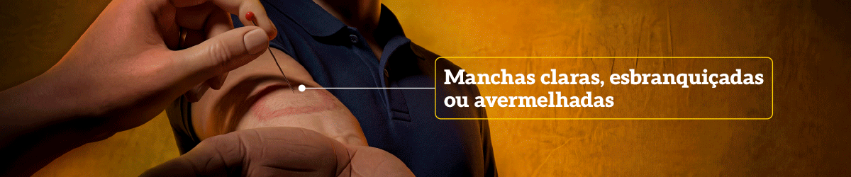 Banner Olho Vivo Cáceres