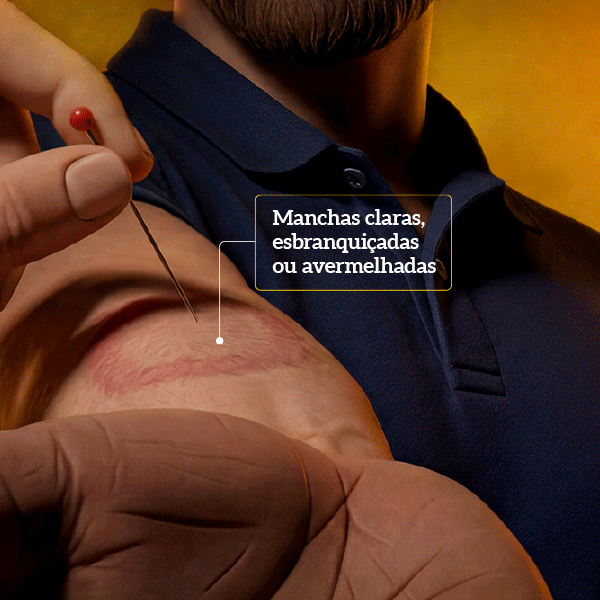 Banner Olho Vivo Cáceres